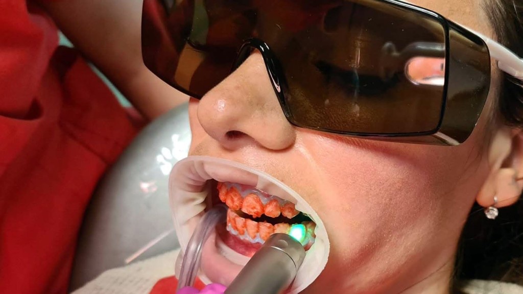 Laser treatment.