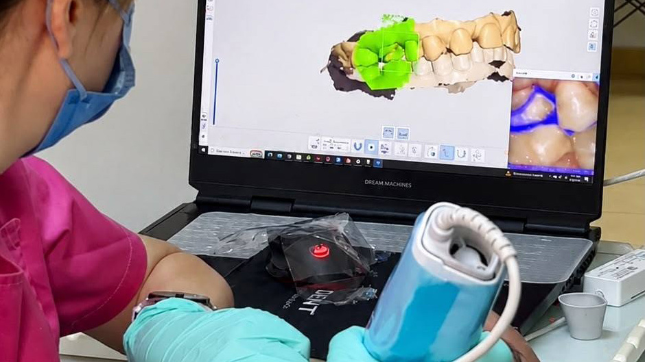 Intraoral scanning.
