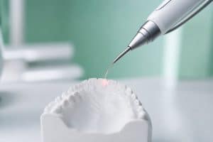 Piesă laser dentar aplicată pe model, pentru tratarea sensibilității dentare